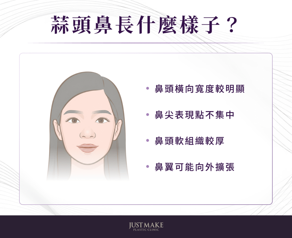 蒜頭鼻長怎樣