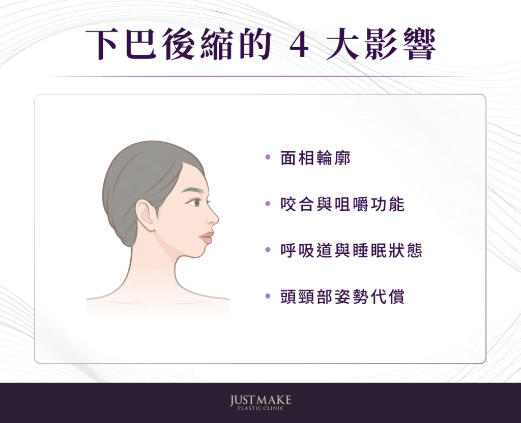 下巴後縮影響