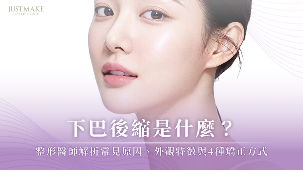 下巴後縮